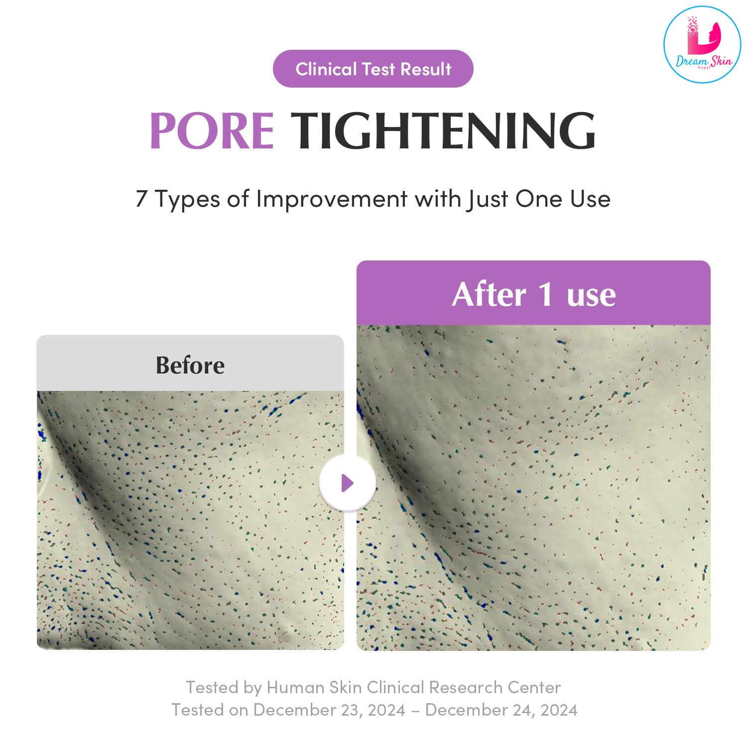 Eqqualberry Purple Rice Pore Purifying Pack Cleanser [130g]